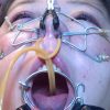 鼻孔からチューブを咽頭に通す過激ハードでマニアックな鼻責めの実録ＳＭ調教動画